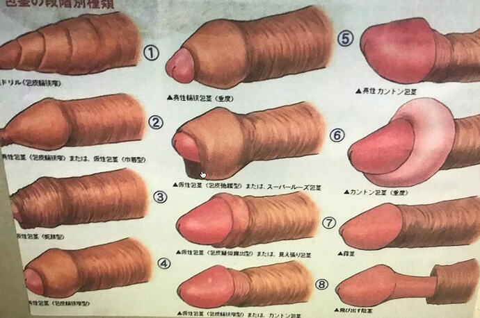31F2553E-3E6B-4CB7-AA1D-E43588C9B0FA_1_102_a